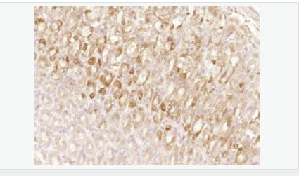 60541088b4033.png image.png