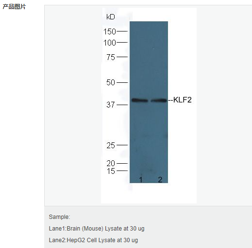 605804dfd1aea.png image.png