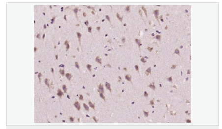 605940fd43ecb.png image.png