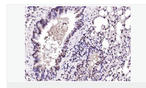 6066ba7d0dc2d.png image.png